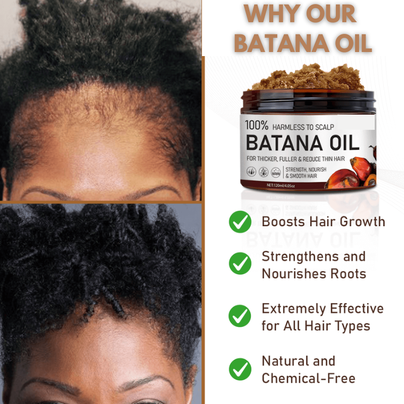 Batana Natural Hair Growth Oil