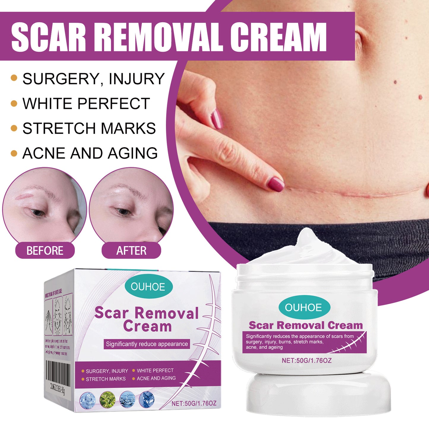 Scar Removal Cream