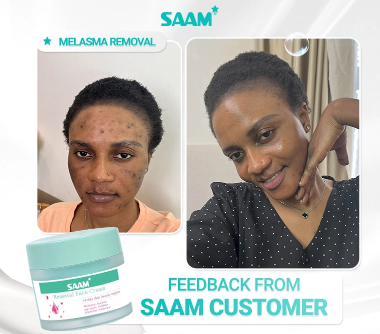 Renewal Face Cream