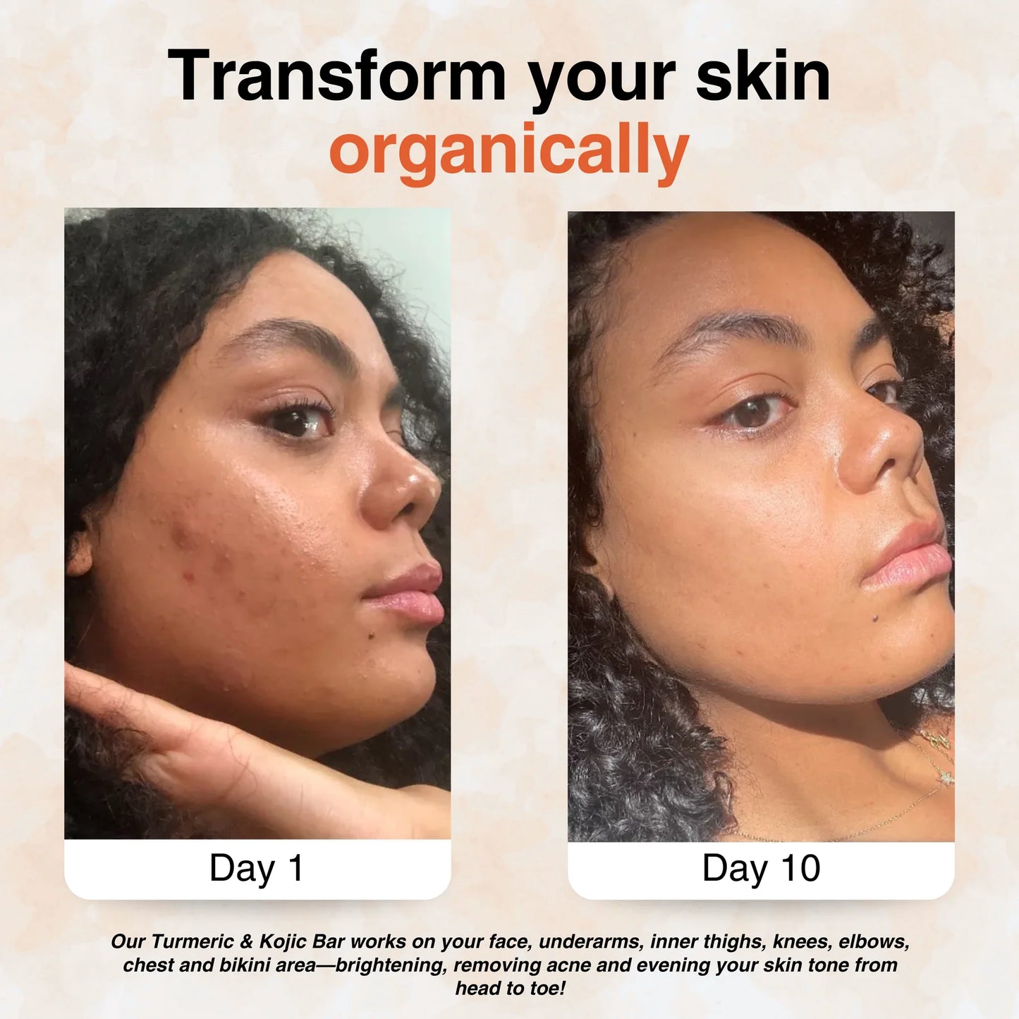 Advanced Turmeric Kojic Acid Soap