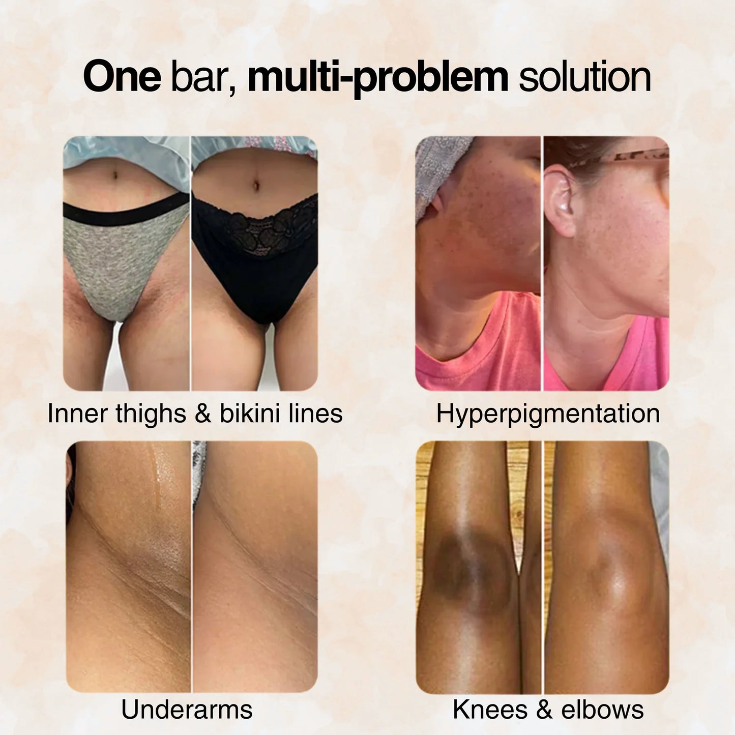 Advanced Turmeric Kojic Acid Soap