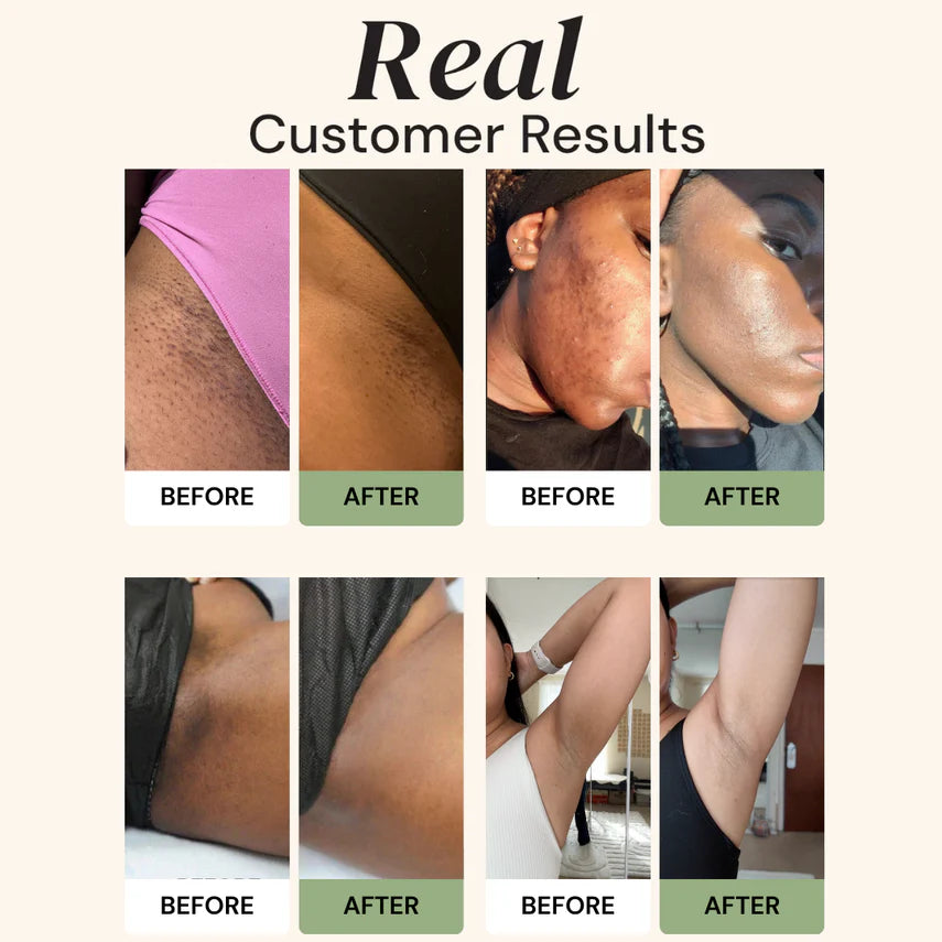 Advanced Turmeric Kojic Acid Soap